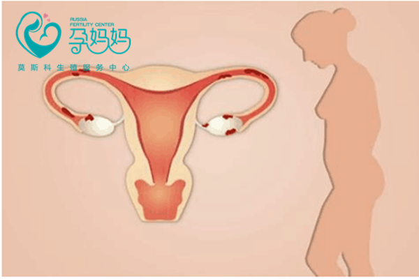 子宫内膜薄是怎么定义的？为什么女性子宫内膜变薄？