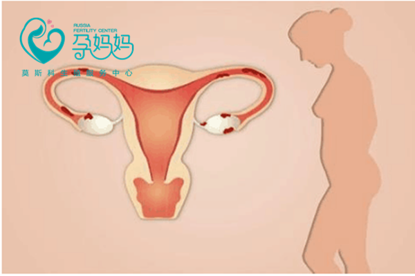 试管婴儿胚胎的着床过程有哪些步骤