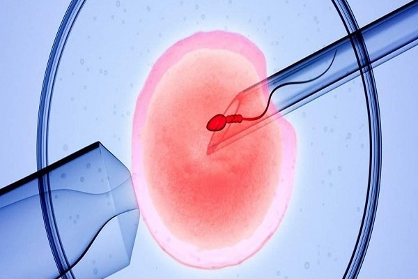囊胚移植前做好充分准备，有效降低失败风险新策略