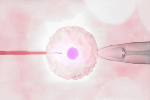 第三代试管婴儿技术：为遗传病风险家庭带来新希望