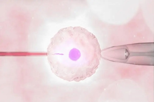 囊胚5aa移植失败：卵巢功能减退或为关键诱因