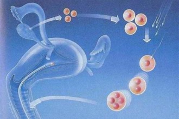 试管促排的成功要素：从医疗到心理的全面准备