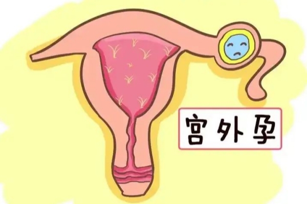 做试管婴儿还有宫外孕风险？预防不良妊娠这样做！