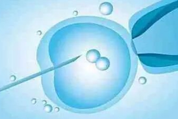 格鲁吉亚试管助孕：自行前往还是选择专业机构？