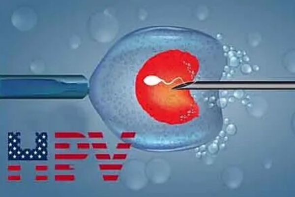 HPV阳性赴美做试管婴儿有影响吗？如何实现健康生育？