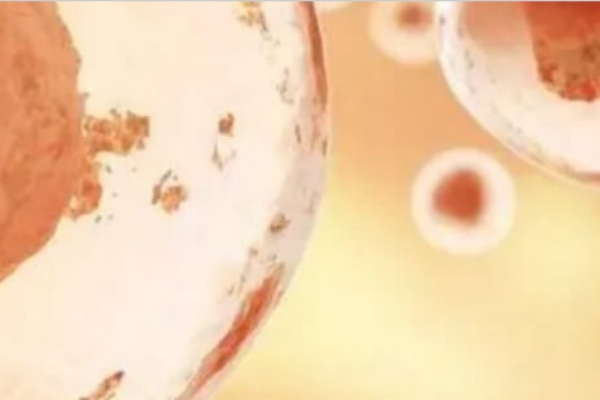 哈萨克斯坦试管助孕：优势背后藏着特殊要求