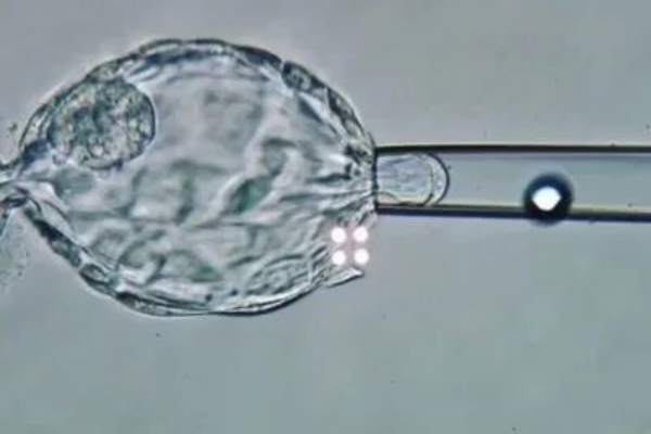 三代试管婴儿胚胎检测会损伤胚胎吗？