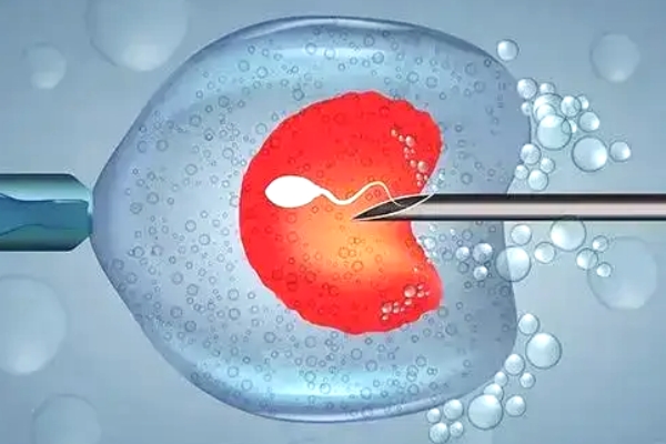 吉尔吉斯斯坦试管五步策略：破解高龄生育困境