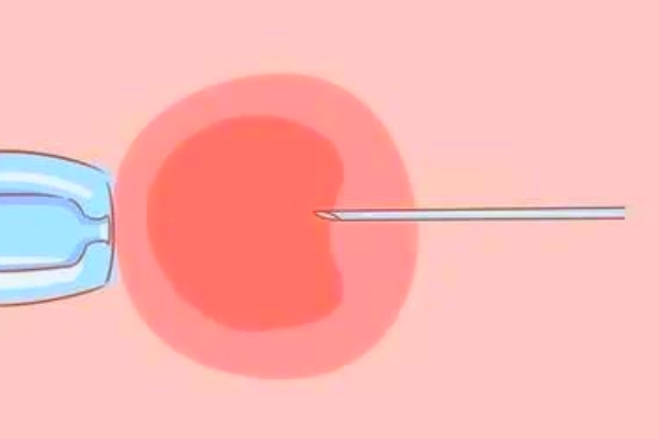 高龄女性赴吉试管：提升成功率策略与特殊情况应对指南